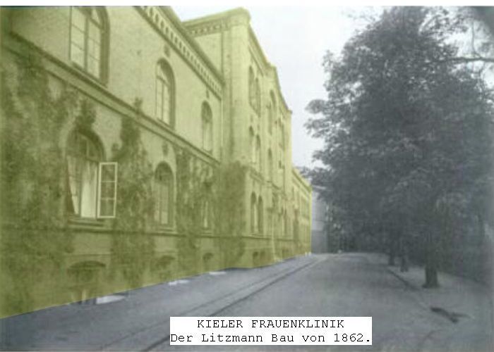 Urgebäude Frauenklinik Kiel 1862