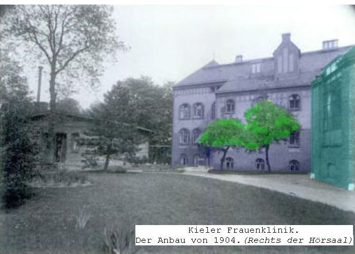 Urgebäude Frauenklinik Kiel 1862 Anbau 1904
