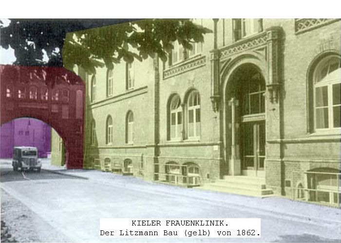 Frauenklinik Kiel von 1862