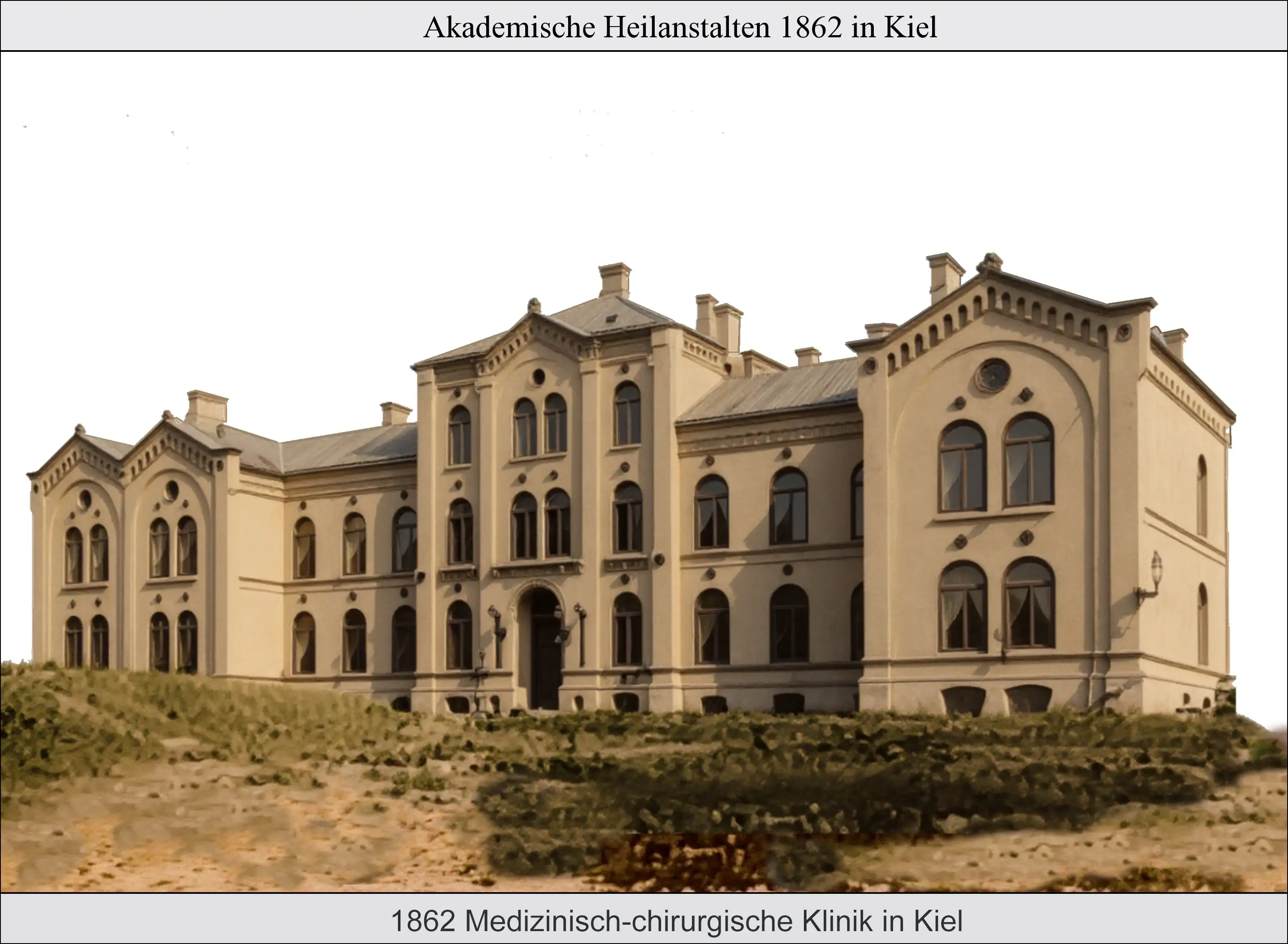 Medizinisch-chirurgische Klinik 1862 in Kiel