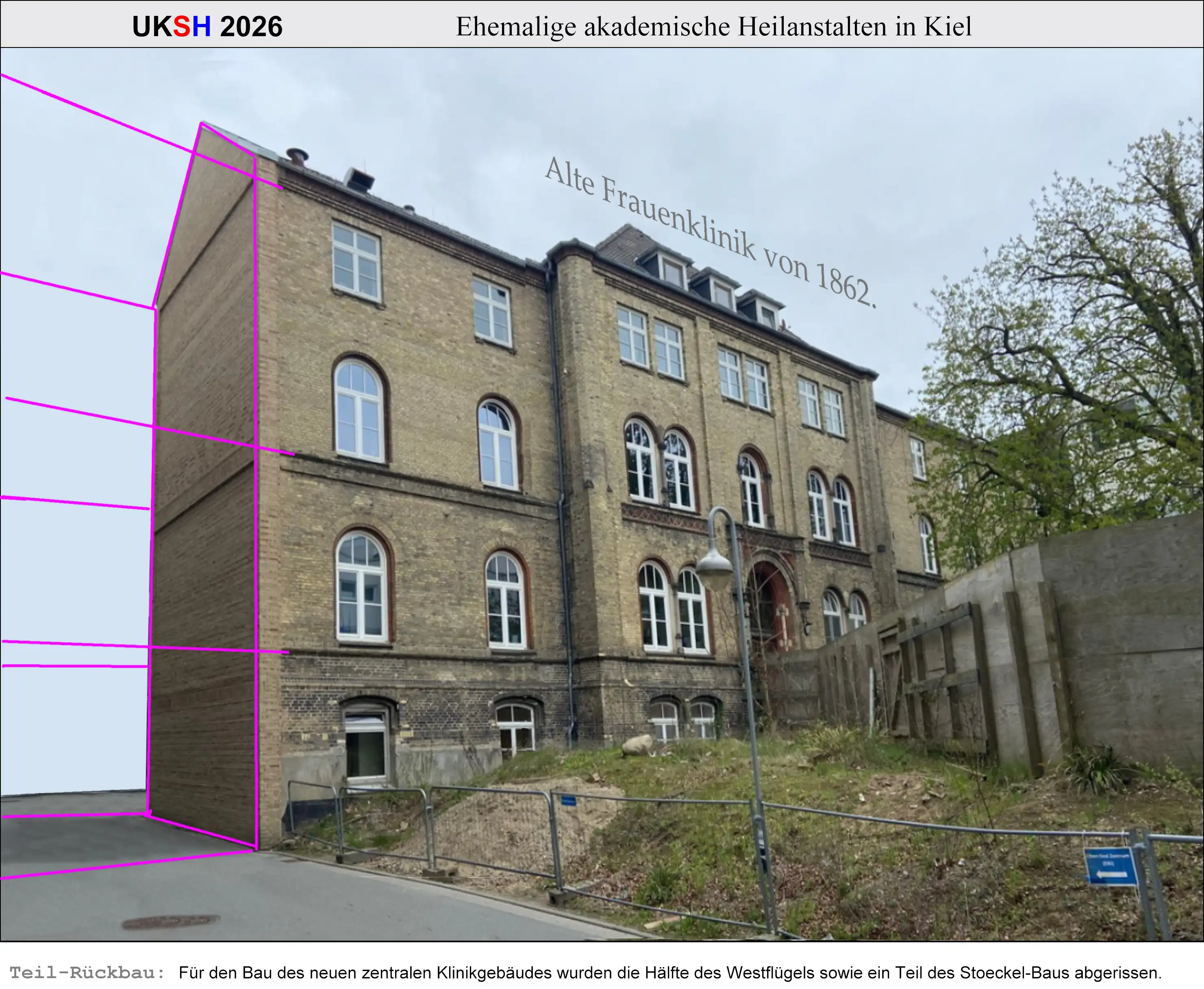 Rest der alten Kieler Frauenklinik 2026